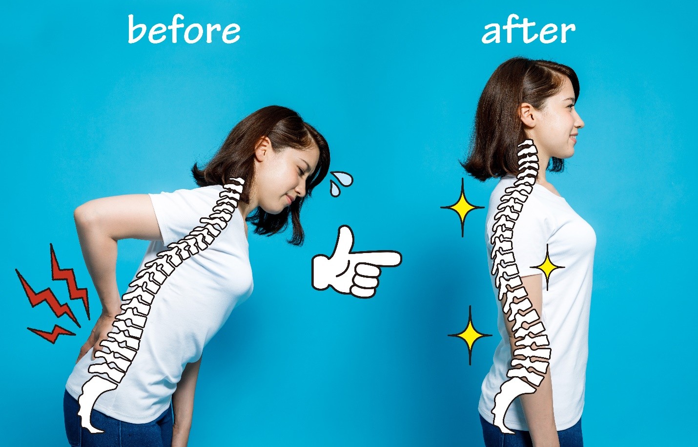 Before and after comparison showing a woman with kyphosis before treatment and correct posture after treatment
