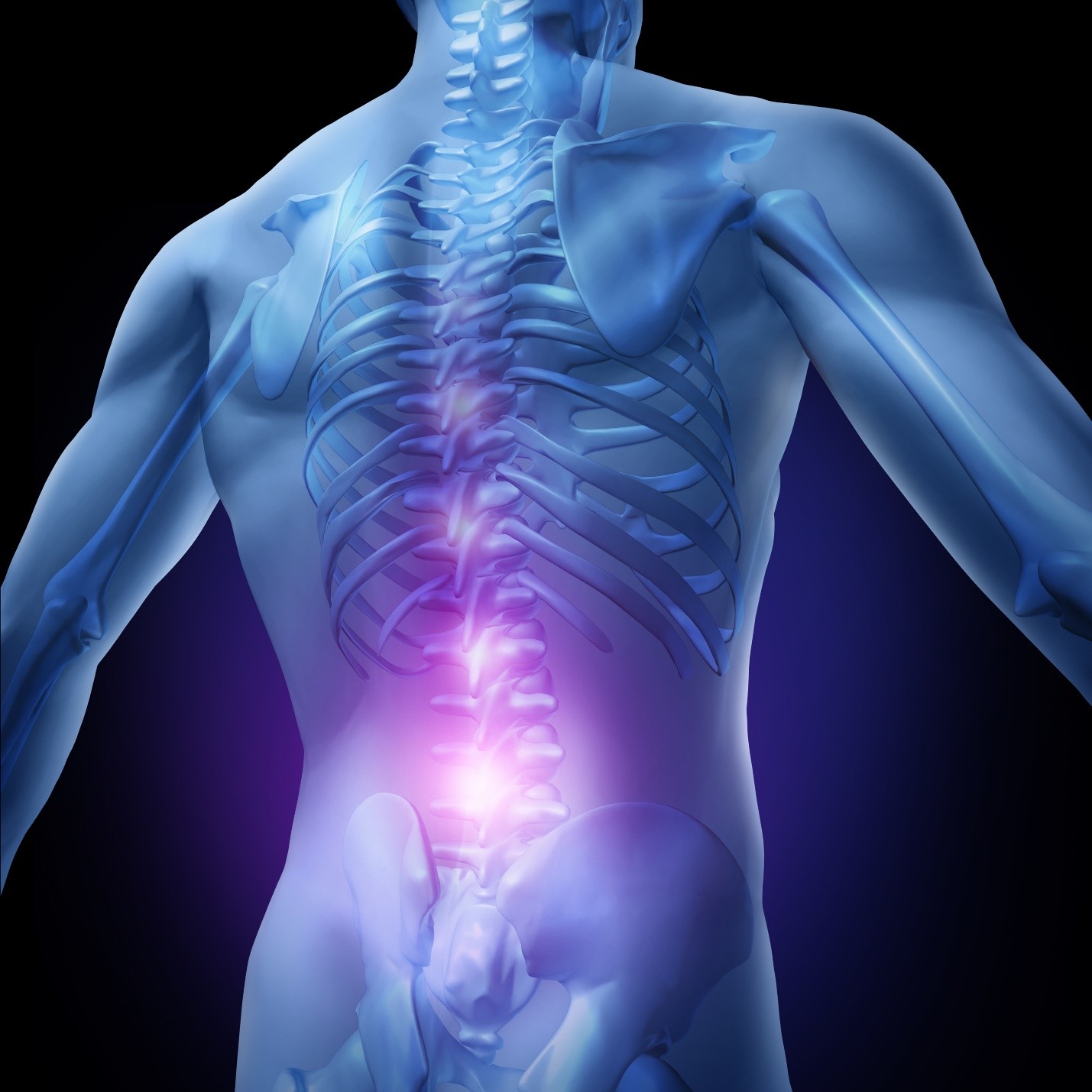 Spondylolisthesis Treatment